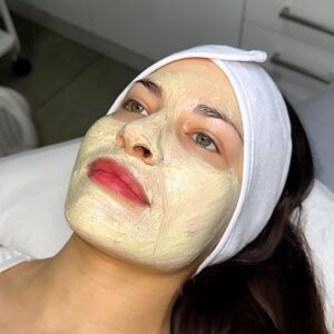 Peeling Químico