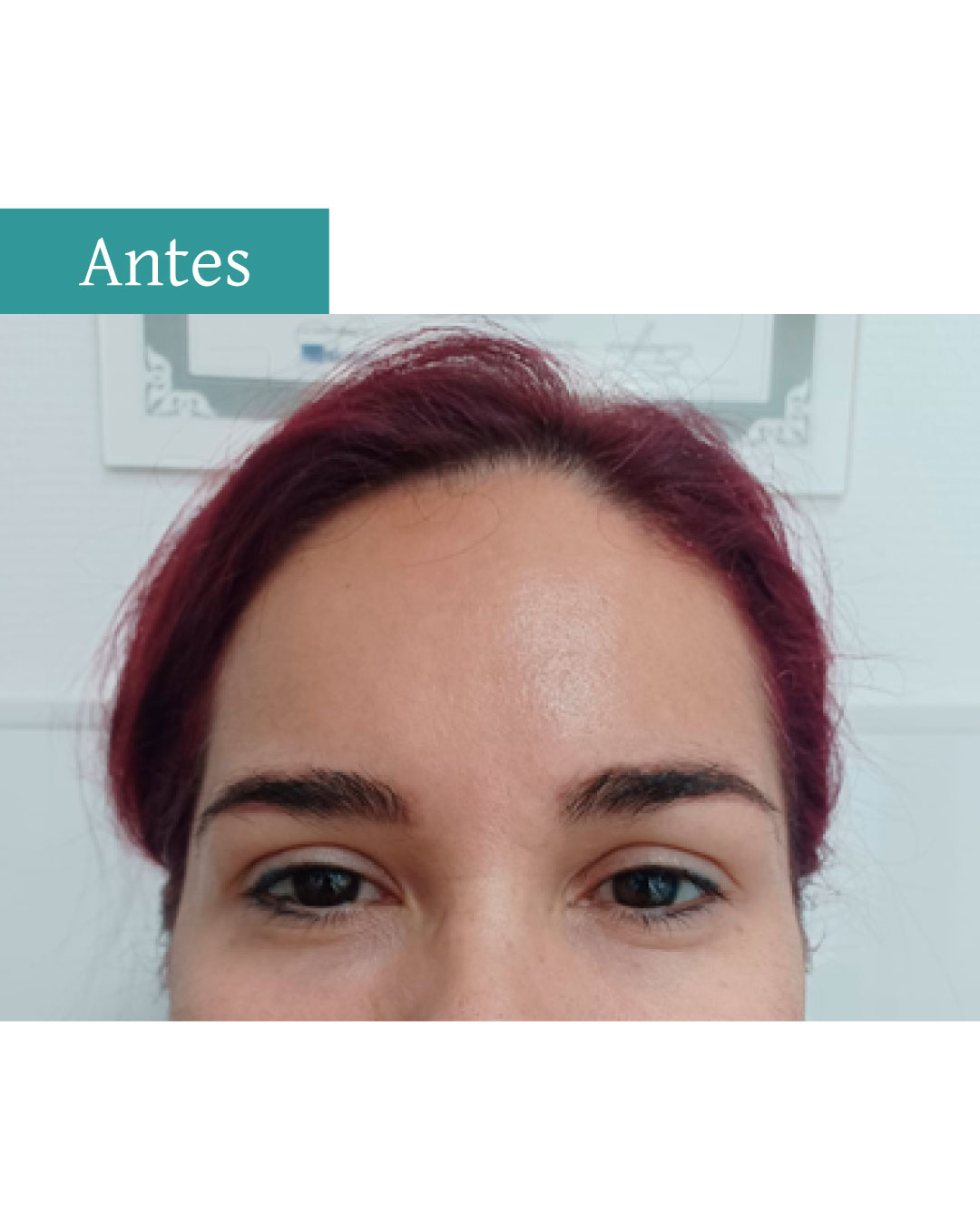 Publicación-de-ojeras--instagram-2