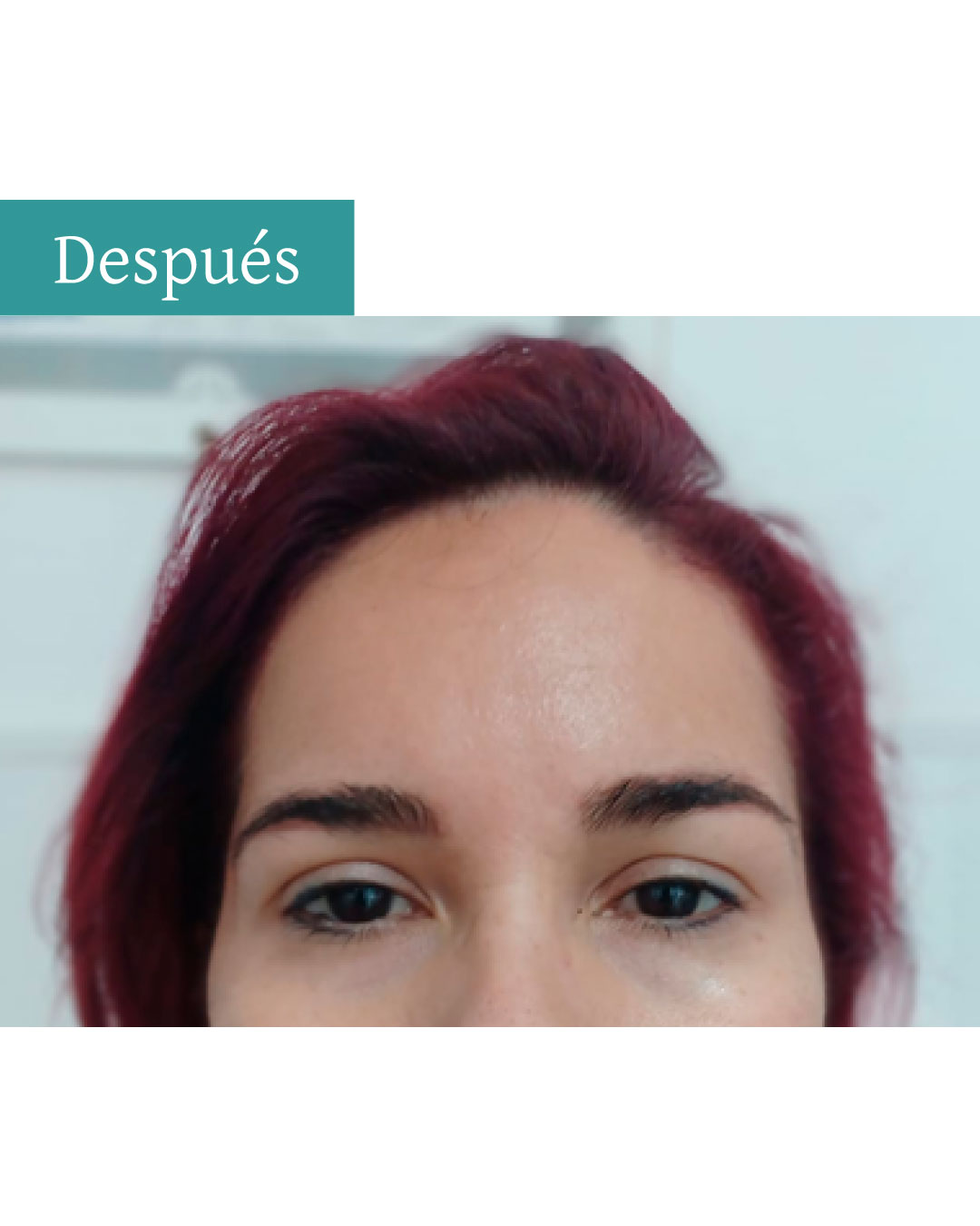 Publicación-de-ojeras--instagram-3